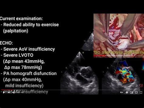 aov repair|AOV Repair .